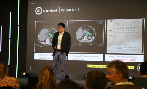 阿里达摩院公布多癌早筛AI最新进展：已服务2000万人次